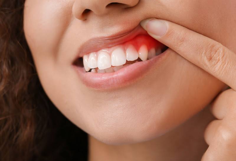 Entenda a Relação Entre Doenças Periodontais E Diabetes